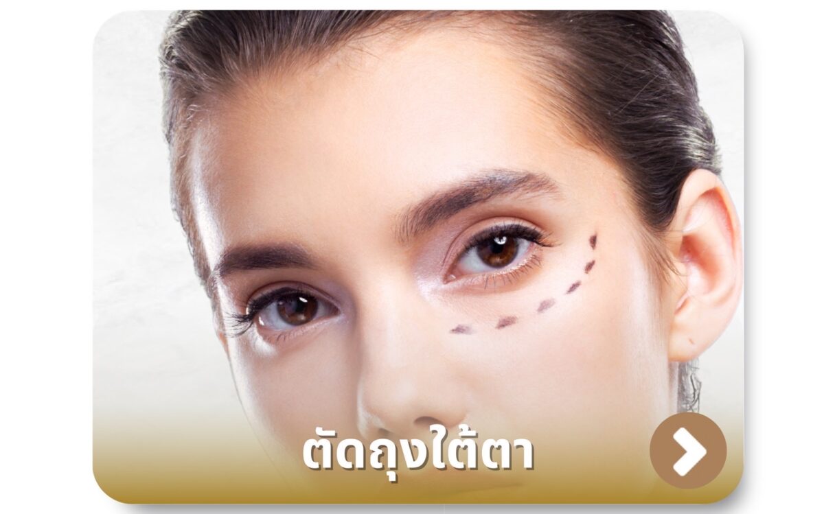 ผ่าตัดถุงใต้ตา
