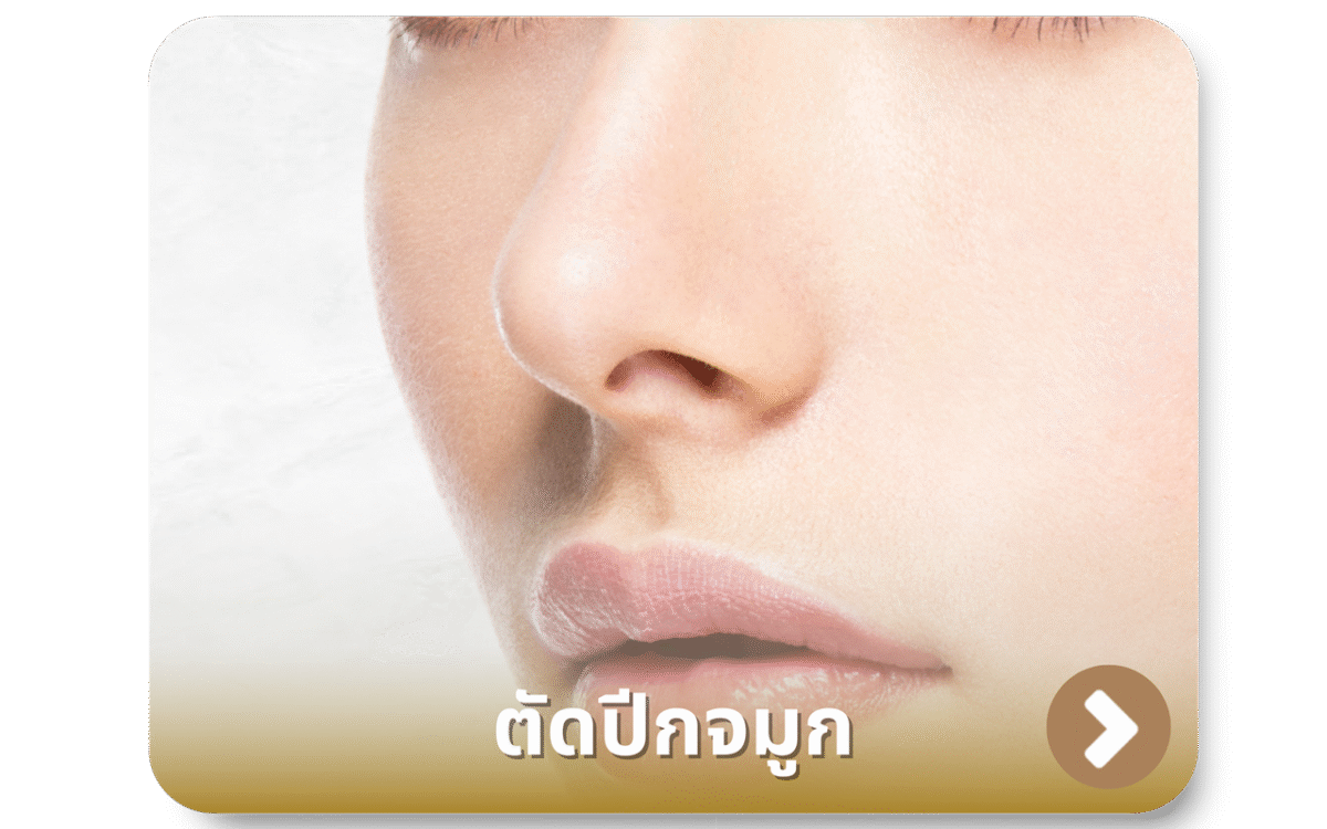 ตัดปีกจมูก